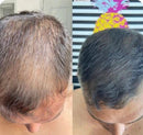 Camuflagem Capilar Profissional FixHair