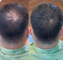 Camuflagem Capilar Profissional FixHair